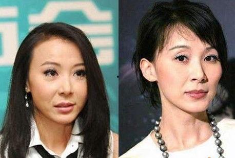 整容失败明星网红