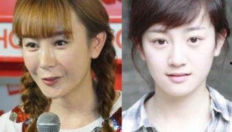 明星网红整容失败,美丽代价与警示