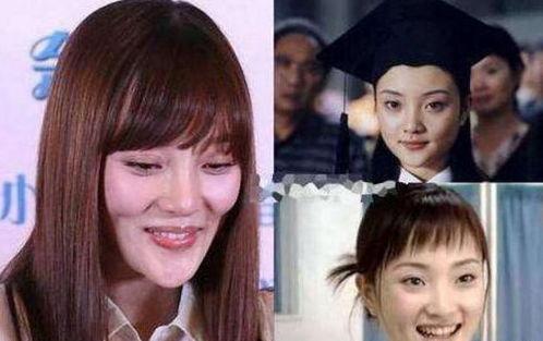 明星网红整容失败,美丽代价与警示